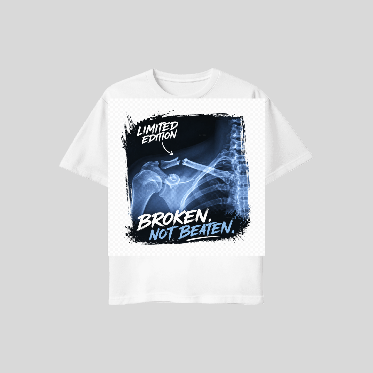 Xray - Weiss